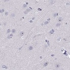 Immunohistochemical staining of human cerebral cortex using Anti-WFDC8 antibody HPA042710.