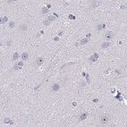 Immunohistochemical staining of human cerebral cortex using Anti-WFDC8 antibody HPA042710.