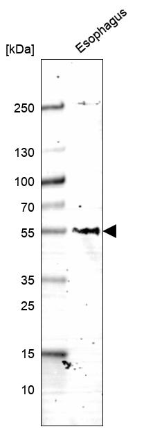 Anti-RHBG Antibody