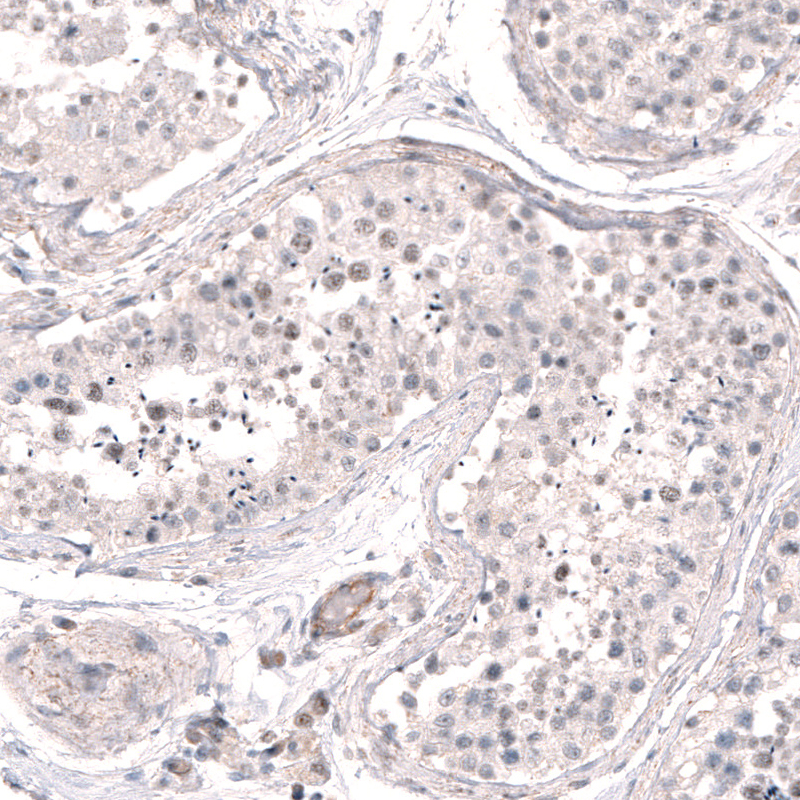 Anti-SMC6 Antibody