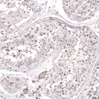 Anti-SMC6 Antibody