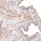 Immunohistochemical staining of human prostate shows weak nuclear positivity in glandular cells.