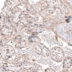 Immunohistochemical staining of human placenta shows weak nuclear positivity in a subset of trophoblastic cells.