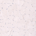 Immunohistochemical staining of human skeletal muscle shows no nuclear positivity in striated muscle fibers as expected.