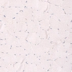 Immunohistochemical staining of human skeletal muscle shows no nuclear positivity in striated muscle fibers as expected.