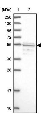 Lane 1: Marker [kDa] 250, 130, 95, 72, 55, 36, 28, 17, 10_br/_Lane 2: Human cell line RT-4