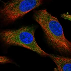 Immunofluorescent staining of human cell line A549 shows localization to cytosol.