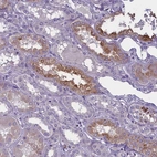 Anti-ENPP6 Antibody