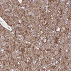 Immunohistochemical staining of human cerebral cortex shows strong positivity in neuronal processes in neuropil.