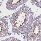 Immunohistochemical staining of human testis shows strong cytoplasmic positivity in cells in seminiferous ducts.