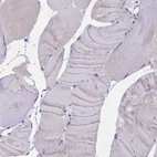 Immunohistochemical staining of human skeletal muscle shows no positivity in myocytes as expected.