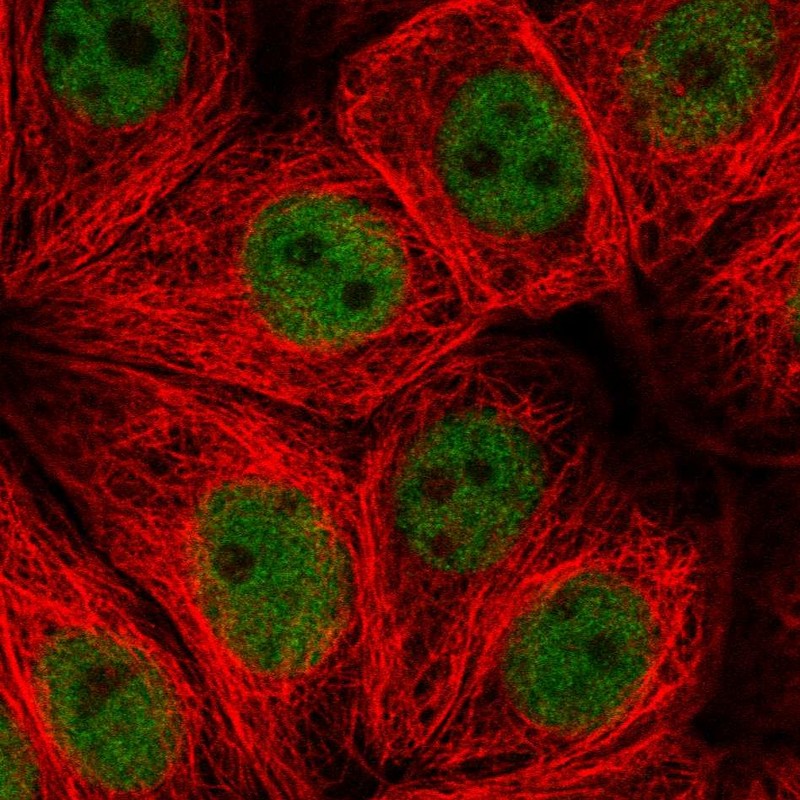 Anti-ZNF821 Antibody