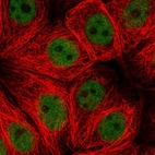 Anti-ZNF821 Antibody