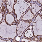 Anti-MRI1 Antibody