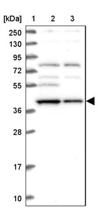 Lane 1: Marker [kDa] 250, 130, 95, 72, 55, 36, 28, 17, 10_br/_Lane 2: Human cell line RT-4_br/_Lane 3: Human cell line U-251MG sp