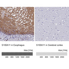 Anti-S100A11 Antibody