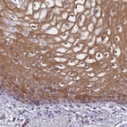 Immunohistochemical staining of human esophagus shows high expression.