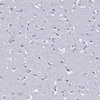 Anti-S100A11 Antibody