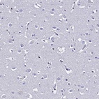Immunohistochemical staining of human cerebral cortex shows low expression as expected.