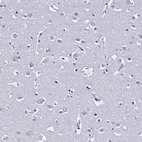 Immunohistochemical staining of human cerebral cortex shows low expression as expected.