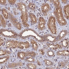 Immunohistochemical staining of human kidney shows moderate to strong cytoplasmic positivity in granular layer.