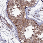 Immunohistochemical staining of human testis shows moderate to strong cytoplasmic positivity in cells in seminiferous ducts.