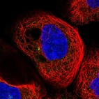 Anti-RIC8B Antibody