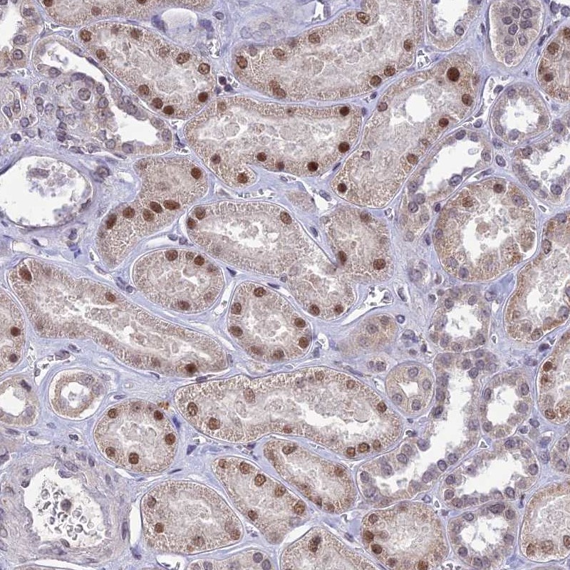 Anti-POP4 Antibody