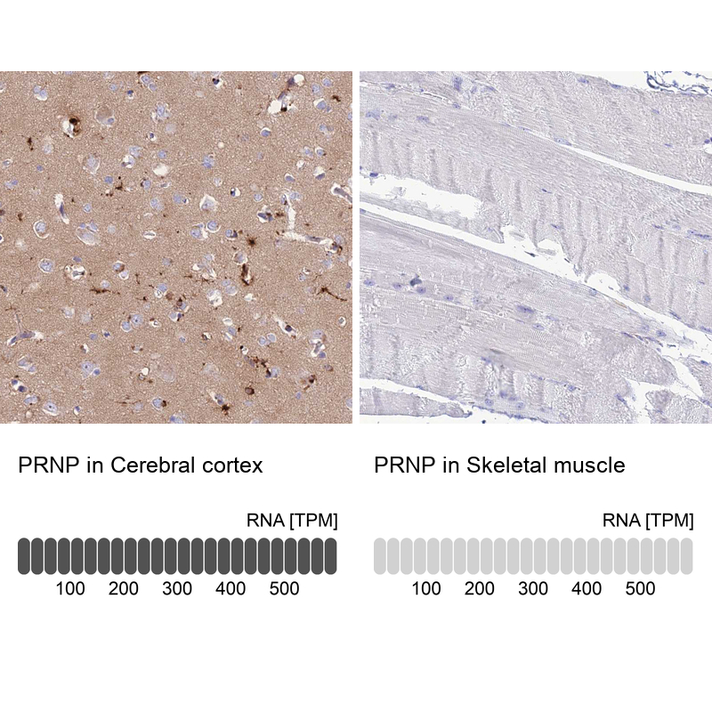 Anti-PRNP Antibody