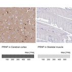 Anti-PRNP Antibody