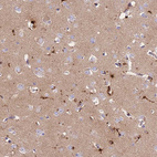 Immunohistochemical staining of human cerebral cortex shows weak to moderate cytoplasmic positivity in neurons.