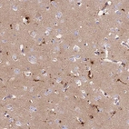 Immunohistochemical staining of human cerebral cortex shows weak to moderate cytoplasmic positivity in neurons.