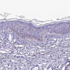 Immunohistochemical staining of human skin shows weak to moderate cytoplasmic positivity in keratinocytes.