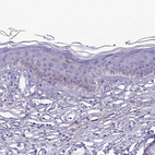 Anti-PRNP Antibody