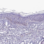 Immunohistochemical staining of human skin shows weak to moderate cytoplasmic positivity in keratinocytes.