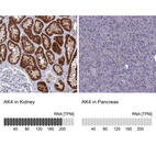 Anti-AK4 Antibody