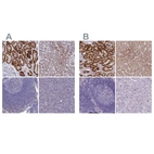 Immunohistochemical staining of human kidney, liver, lymph node and pancreas using Anti-AK4 antibody HPA042753 (A) shows similar protein distribution across tissues to independent antibody HPA049461 (B).