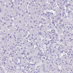Immunohistochemical staining of human liver shows weak to moderate cytoplasmic positivity in hepatocytes.