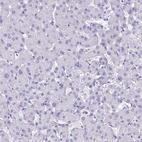 Immunohistochemical staining of human liver shows weak to moderate cytoplasmic positivity in hepatocytes.