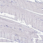 Immunohistochemical staining of human skeletal muscle shows no positivity in myocytes as expected.