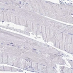 Immunohistochemical staining of human skeletal muscle shows no positivity in myocytes as expected.