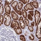 Immunohistochemical staining of human kidney shows strong granular cytoplasmic positivity in cells in tubules.