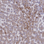 Immunohistochemical staining of human liver shows moderate granular cytoplasmic positivity in hepatocytes.