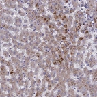 Immunohistochemical staining of human liver shows moderate granular cytoplasmic positivity in hepatocytes.