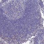Immunohistochemical staining of human lymph node shows no positivity in germinal center cells as expected.