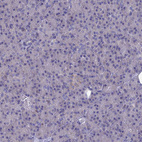 Anti-AK4 Antibody