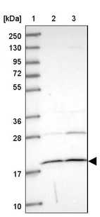 Lane 1: Marker [kDa] 250, 130, 95, 72, 55, 36, 28, 17, 10_br/_Lane 2: Human cell line RT-4_br/_Lane 3: Human cell line U-251MG sp