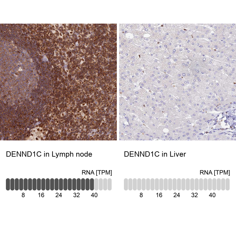 Anti-DENND1C Antibody
