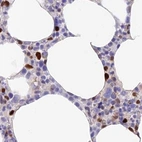 Immunohistochemical staining of human bone marrow using Anti-DENND1C antibody HPA042758.