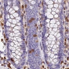 Immunohistochemical staining of human colon using Anti-DENND1C antibody HPA042758.